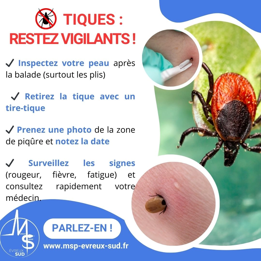 Avec le retour des beaux jours, les tiques réapparaissent dans les forêts, les jardins et les zones herbeuses. Ces petits parasites peuvent transmettre des maladies, notamment la maladie de Lyme, (1)